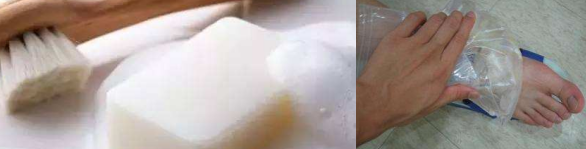 被紅火蟻咬傷后的緊急處理方法