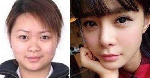 沈夢辰原來的樣子的圖片(沈夢辰整容前后對比)