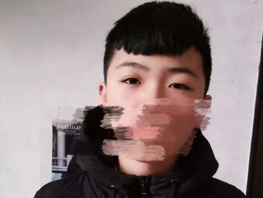 雙眼皮最晚幾歲長出來(慢慢長出雙眼皮的特征)
