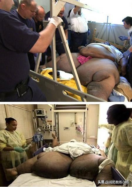 世界上最胖的人（世界上最胖的人1.8噸）