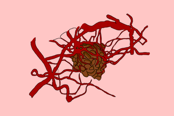 人一旦化療還能活幾年（為什么化療后人就活不久了）