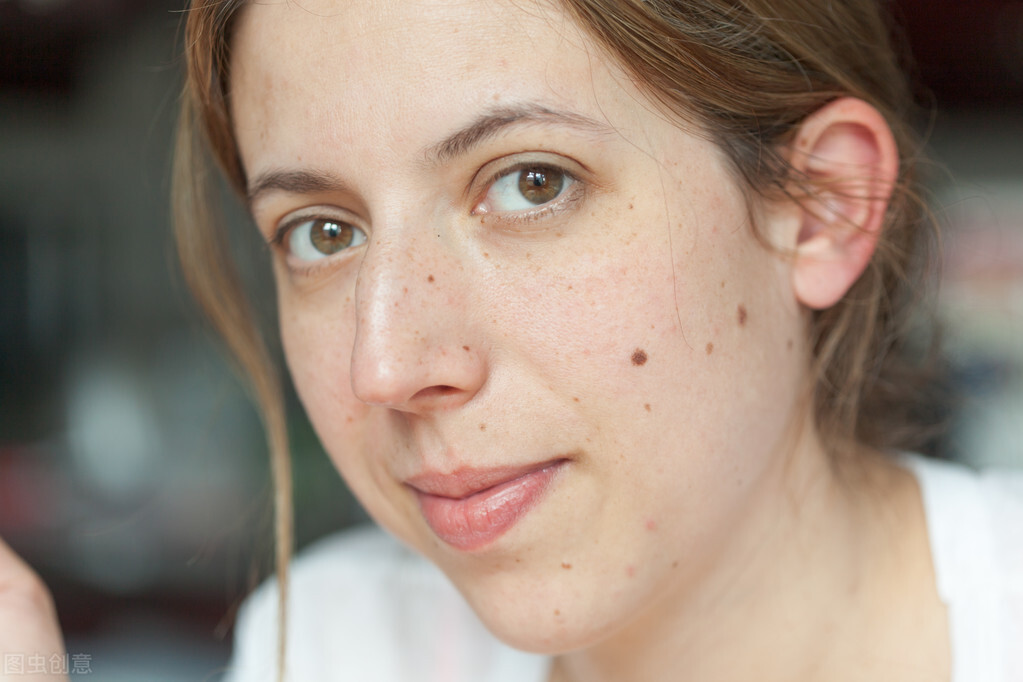 身上紅痣是怎么回事（女人身上長紅痣越來越多）