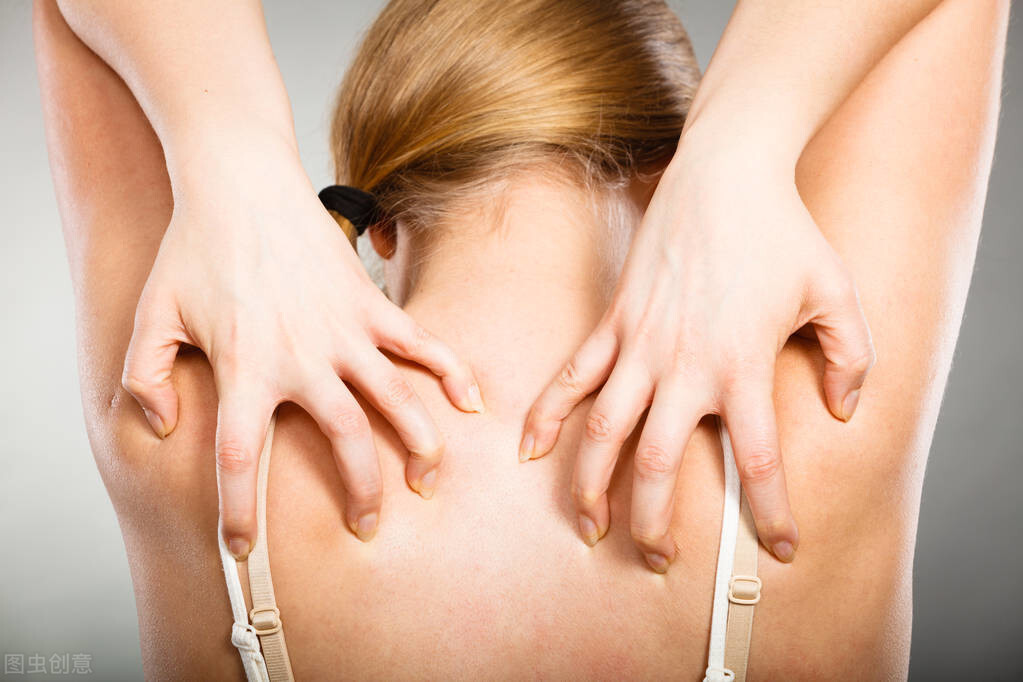 身上紅痣是怎么回事（女人身上長紅痣越來越多）