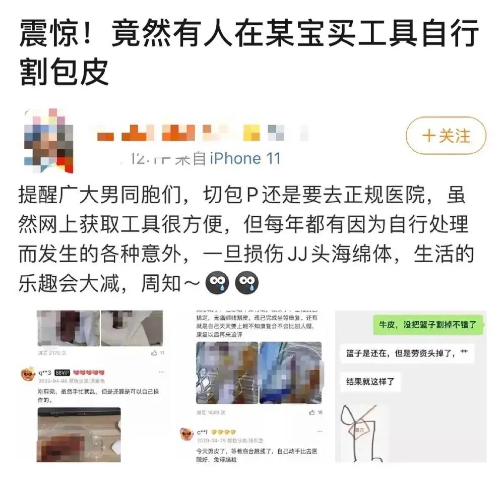 割包為什么很多人后悔 (成年割包好處和壞處)