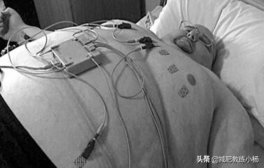 世界上最胖的人（世界上最胖的人1.8噸）