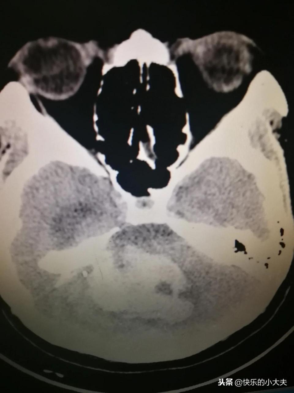為什么放棄治療 (放棄治療必須得出院嗎)