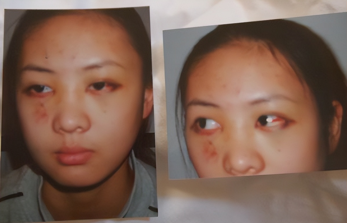 黃定宇控制童瑤長達一年是真的嗎