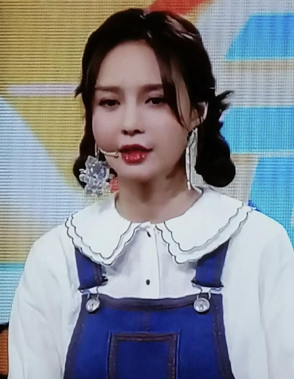 沈夢辰原來的樣子的圖片(沈夢辰整容前后對比)