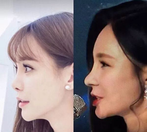 沈夢辰原來的樣子的圖片(沈夢辰整容前后對比)