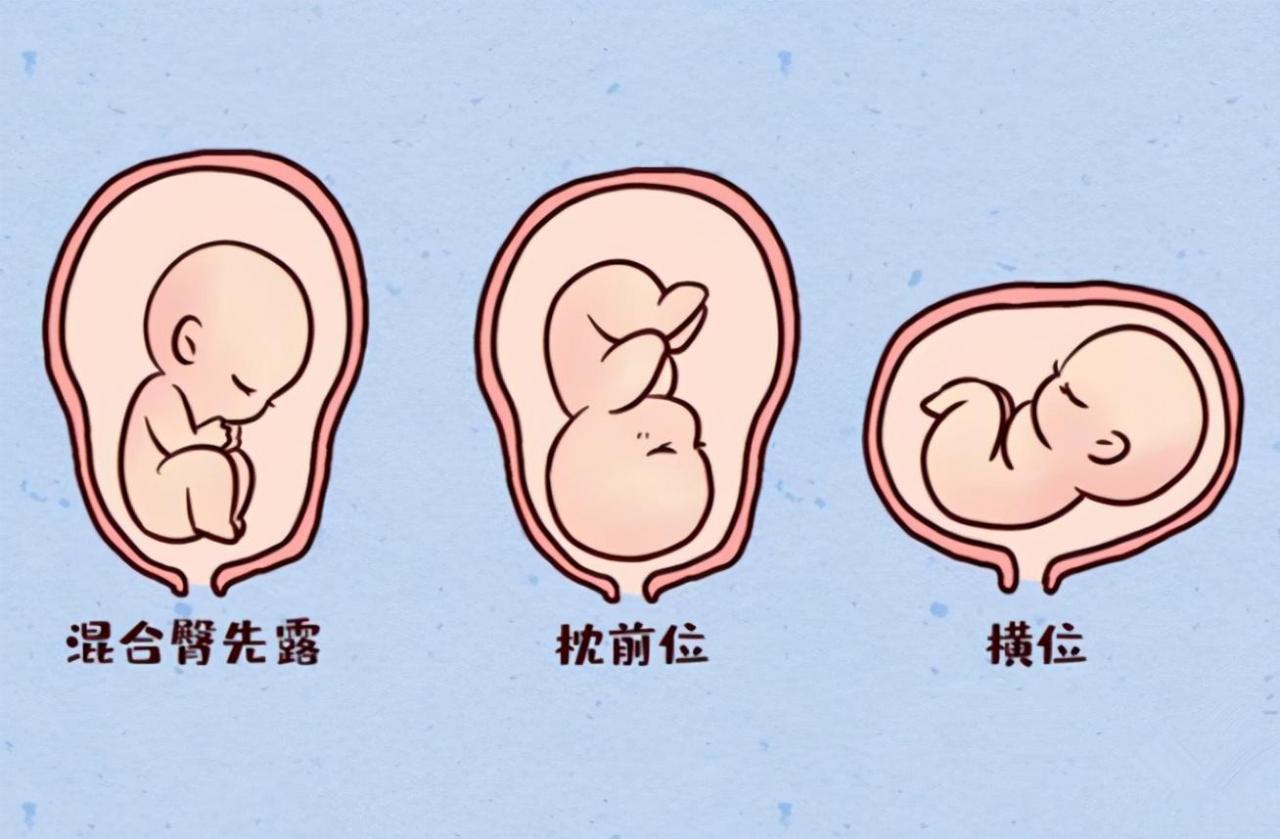男孩和女孩鼓包區別圖(孕肚鼓包和不鼓包的因素)