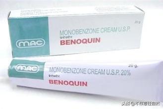 邁克爾杰克遜怎么變白的(邁克爾杰克遜怎么變白的)