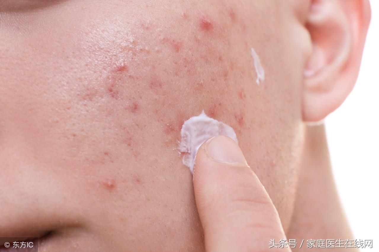 螨蟲最怕這3種東西（3招助你“消滅”螨蟲）