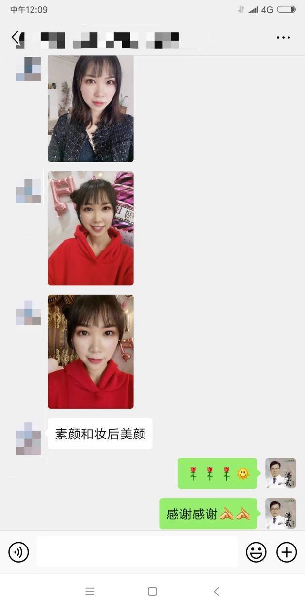 開眼角前后對比照片 開眼角失敗的八種圖片