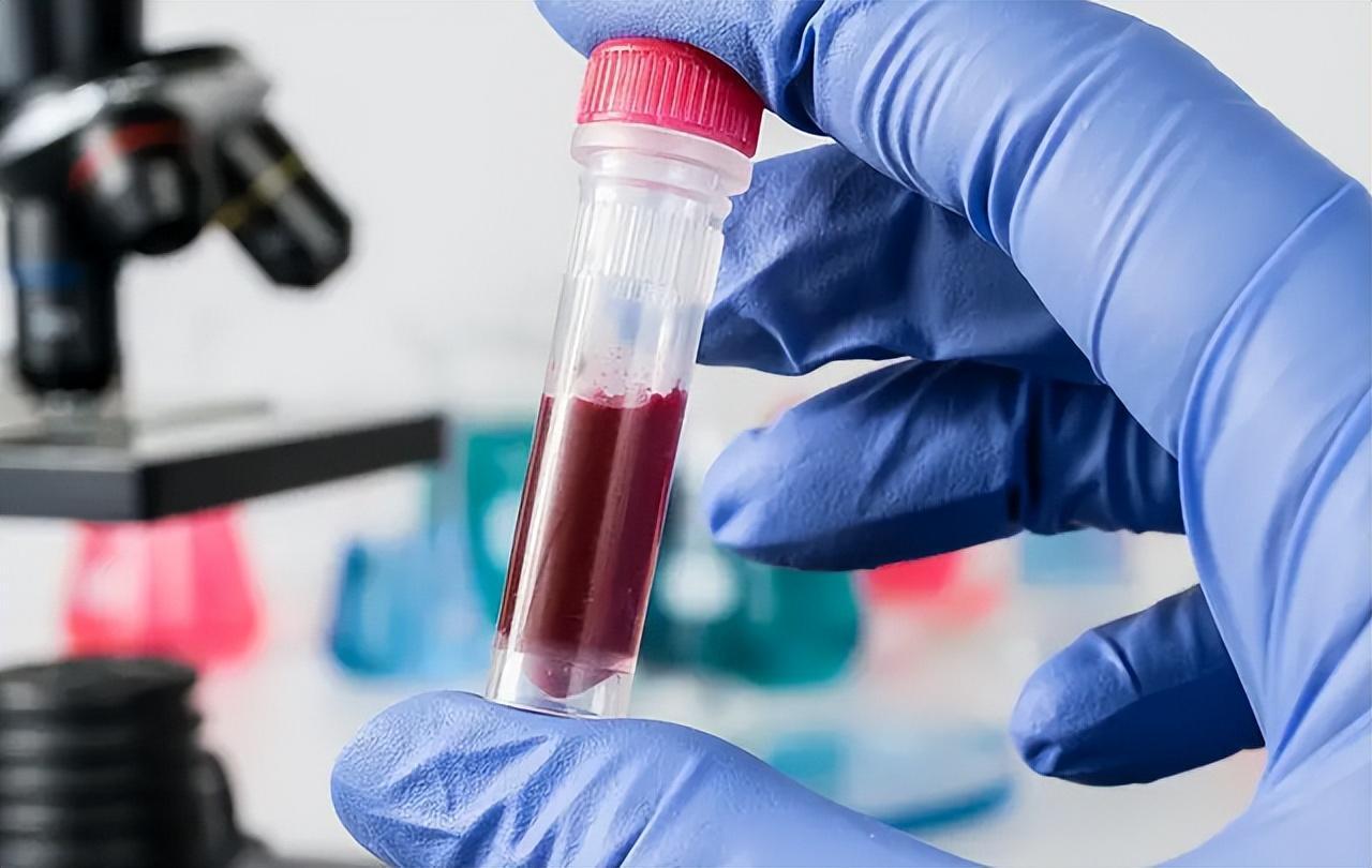 淋巴細(xì)胞比率偏高是什么意思(淋巴細(xì)胞比率偏高是什么意思怎么治)