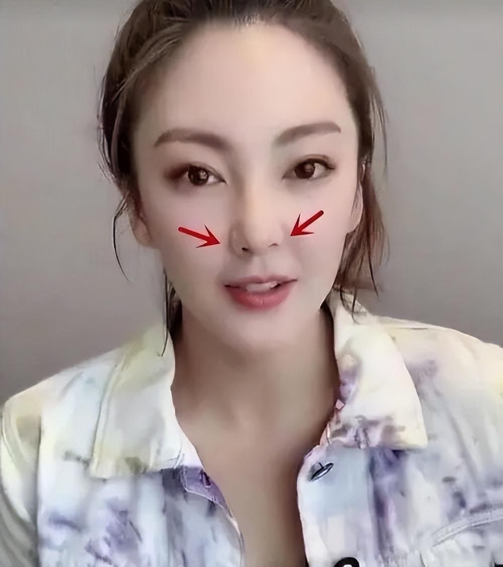 柳巖為什么嘴歪(柳巖嘴歪面相)