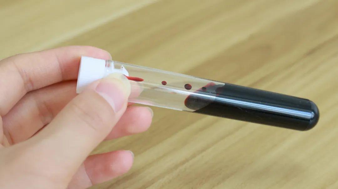 艾滋病的傳染途徑有哪些(艾滋病是怎么傳染的)