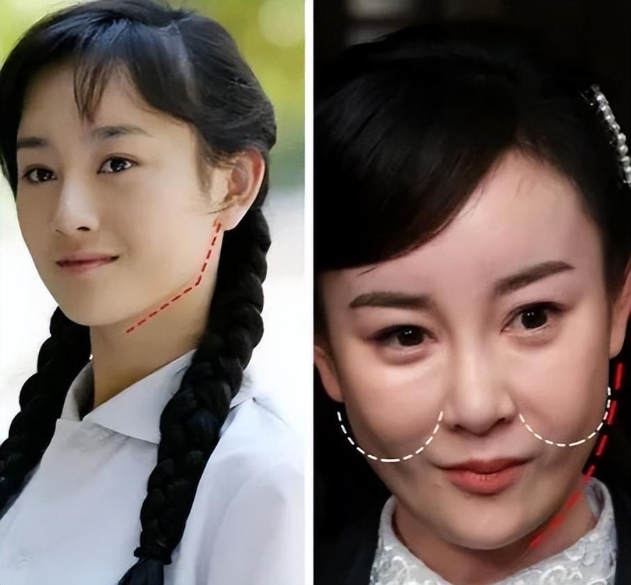 柳巖為什么嘴歪(柳巖嘴歪面相)