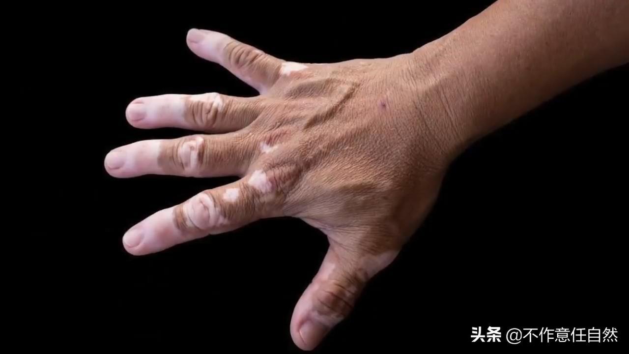 邁克爾杰克遜怎么變白的(邁克爾杰克遜怎么變白的)