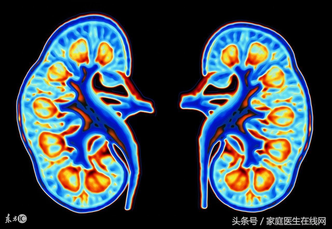 腎排毒吃哪些食物(腎排毒吃什么最好)