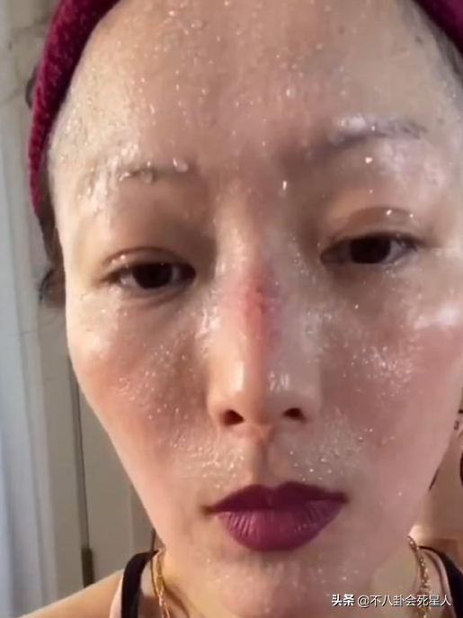 劉嘉玲為什么不能生育(張茜為什么不能生育)