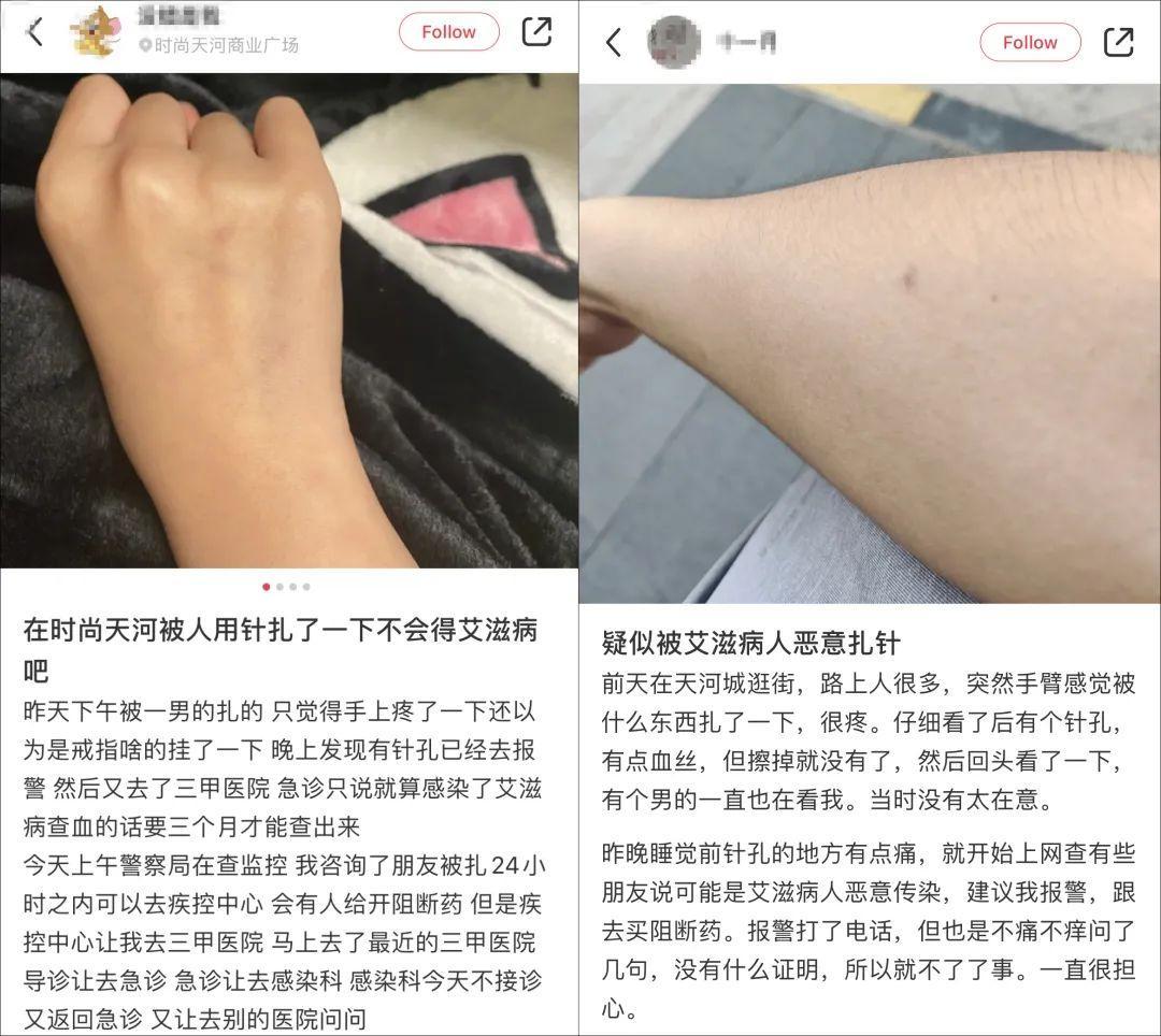 廣州警方通報網友稱疑遭惡意扎針,案件已在進一步偵察中