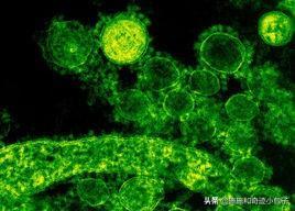 貓傳腹是怎么引起的(罪魁禍?zhǔn)资秦埞跔畈《荆? width=